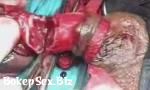 Video Bokep Online penectomy, 3gp