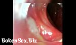 Vidio Sex Endoscope 100cm deep anal insertion mp4