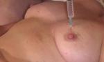 Video Bokep Analslut - First Breast Inflation! left breas