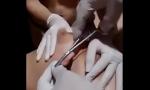 Download Video Bokep Saline injectionma; neddle and fisting terbaik