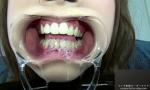 Bokep Video Teeth fetish terbaru