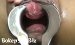 Video Bokep Online Asian speculum 3gp