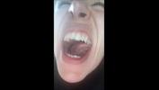 Film Bokep i need a dentist right now excl mp4