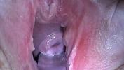 Nonton Video Bokep Cum Injection with Syringe in Cervix Utherus after Fucking 3gp