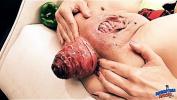 Download vidio Bokep Insanely Huge Prolapse excl Cervix Exposure period Eggplant Penetratio